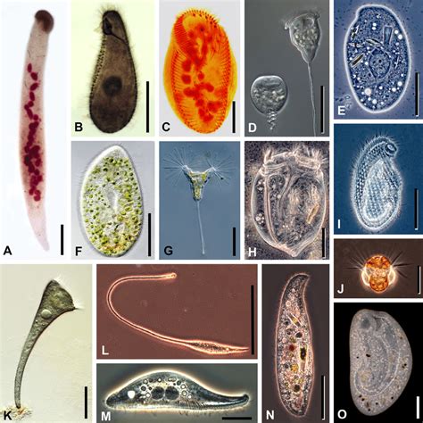  Rhoptoria! A Ciliate That Dances With its Prey