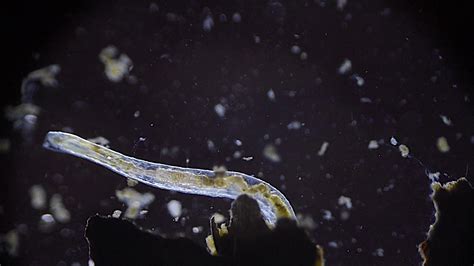  Isotoma! This Remarkable Microscopic Worm Is An Aquatic Enigma With A Voracious Appetite